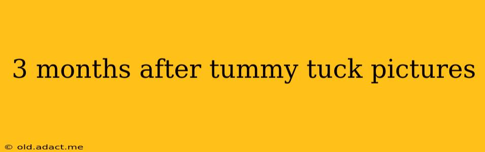 3 months after tummy tuck pictures