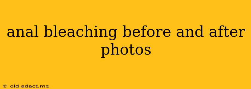 anal bleaching before and after photos