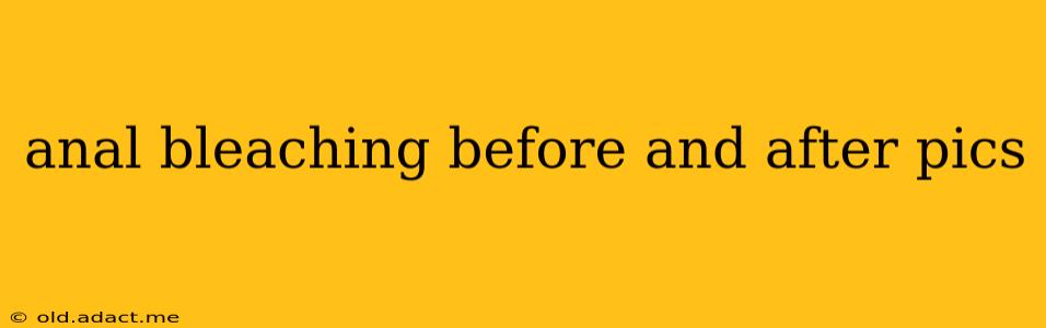 anal bleaching before and after pics