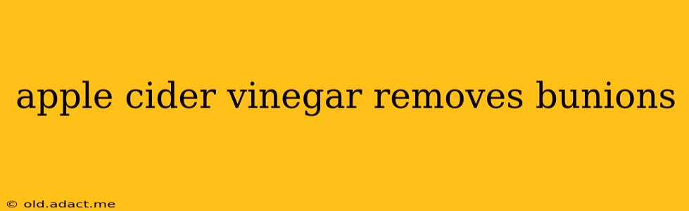 apple cider vinegar removes bunions
