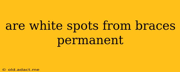 are white spots from braces permanent