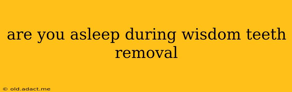 are you asleep during wisdom teeth removal