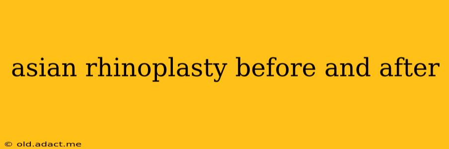 asian rhinoplasty before and after