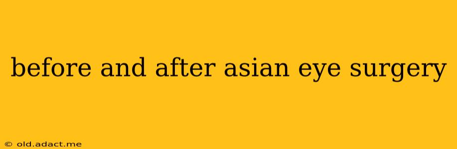 before and after asian eye surgery