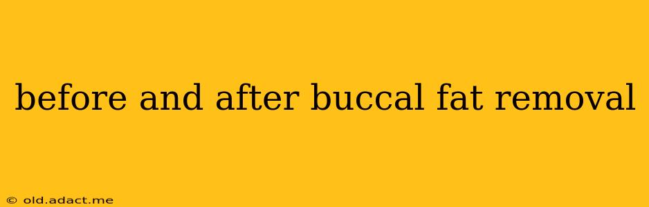 before and after buccal fat removal