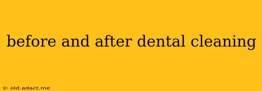 before and after dental cleaning