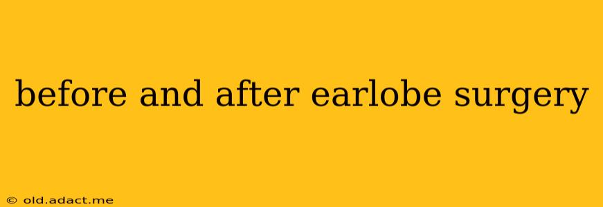 before and after earlobe surgery
