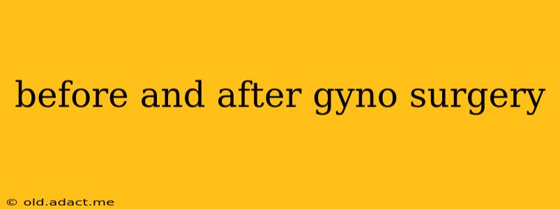 before and after gyno surgery