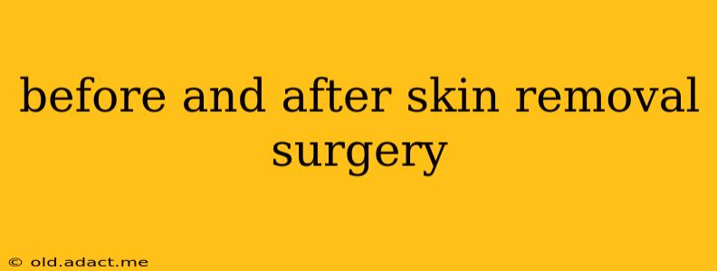 before and after skin removal surgery