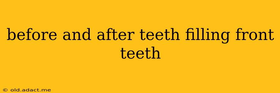 before and after teeth filling front teeth