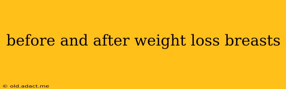 before and after weight loss breasts