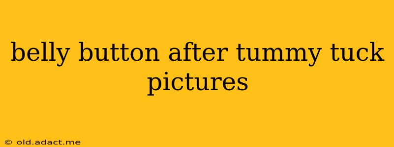 belly button after tummy tuck pictures