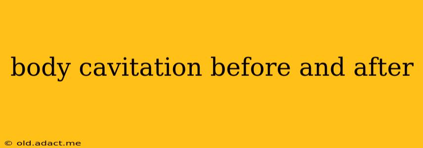 body cavitation before and after