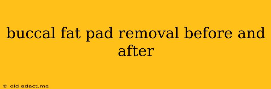 buccal fat pad removal before and after