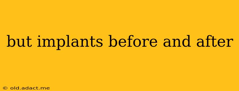 but implants before and after