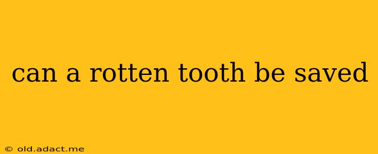 can a rotten tooth be saved