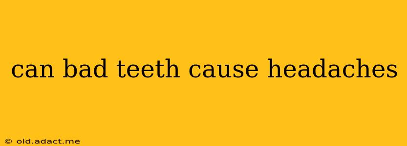 can bad teeth cause headaches