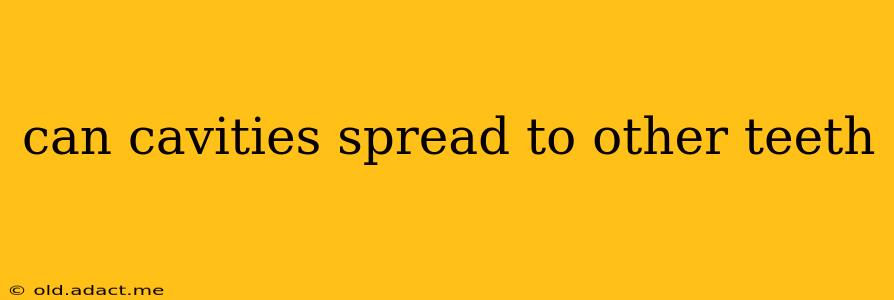 can cavities spread to other teeth