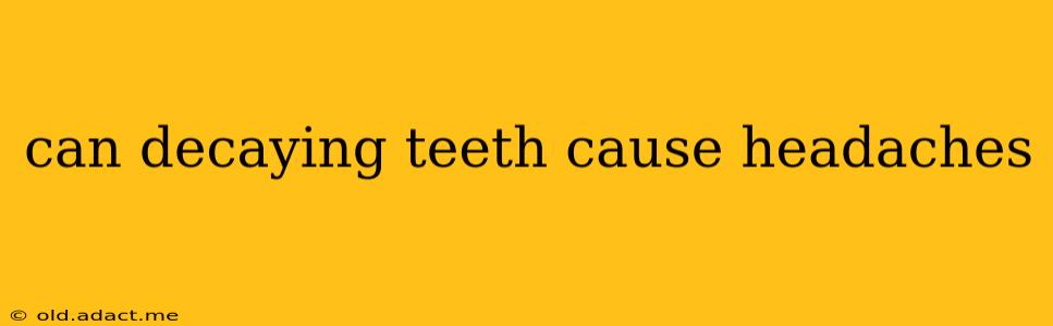 can decaying teeth cause headaches