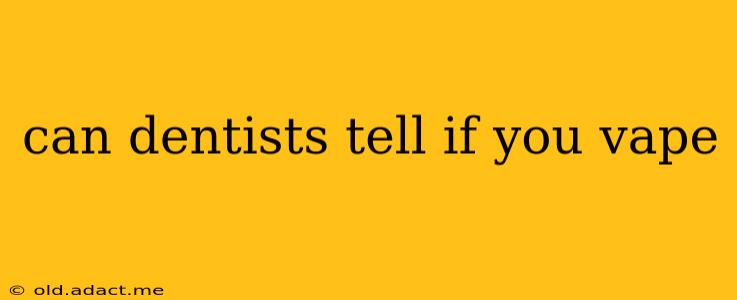 can dentists tell if you vape