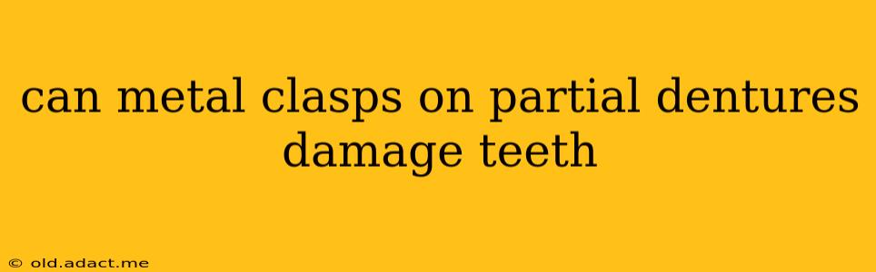 can metal clasps on partial dentures damage teeth