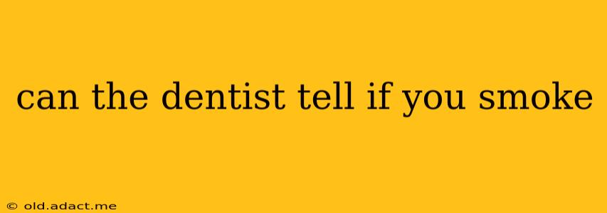 can the dentist tell if you smoke