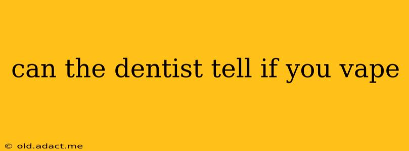 can the dentist tell if you vape