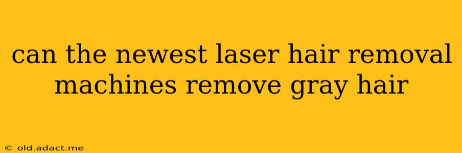 can the newest laser hair removal machines remove gray hair