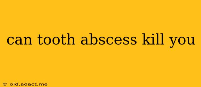 can tooth abscess kill you