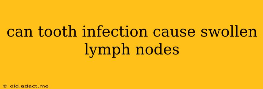 can tooth infection cause swollen lymph nodes