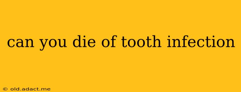 can you die of tooth infection