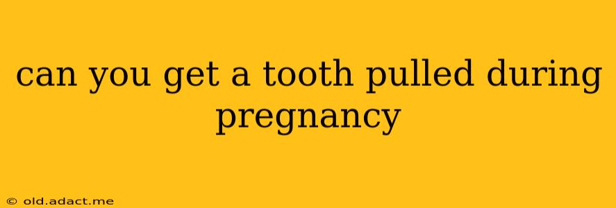 can you get a tooth pulled during pregnancy