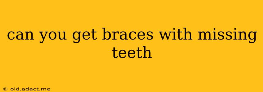 can you get braces with missing teeth