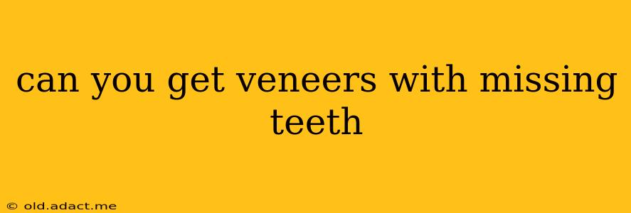 can you get veneers with missing teeth