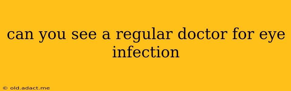 can you see a regular doctor for eye infection