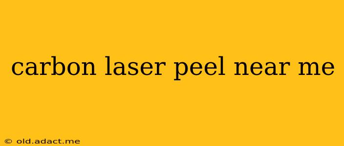 carbon laser peel near me