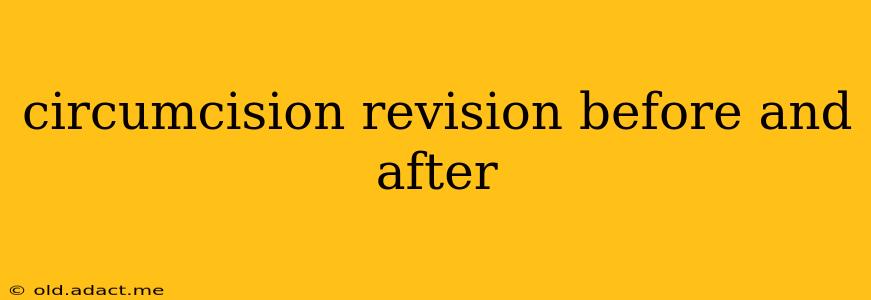 circumcision revision before and after