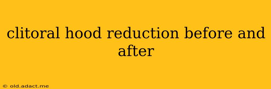 clitoral hood reduction before and after