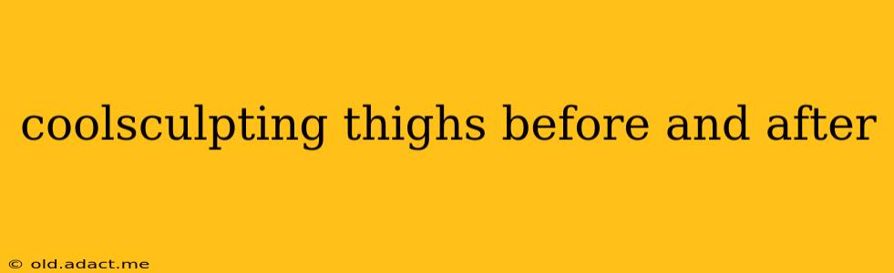 coolsculpting thighs before and after