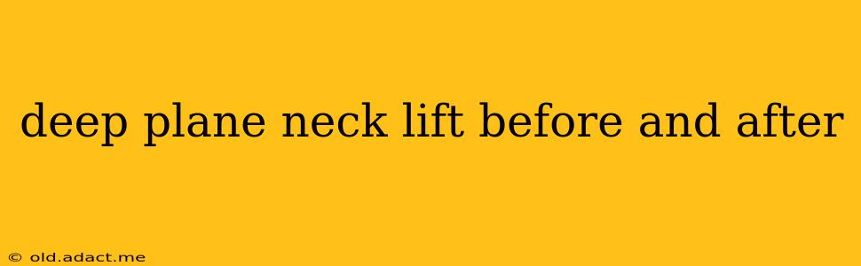 deep plane neck lift before and after
