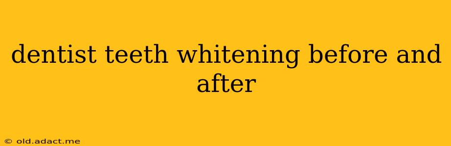 dentist teeth whitening before and after