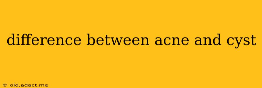 difference between acne and cyst