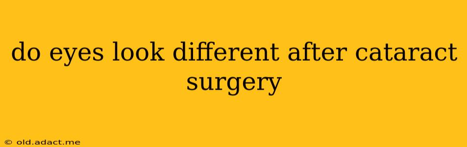 do eyes look different after cataract surgery