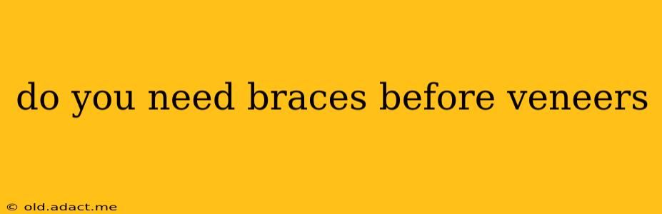 do you need braces before veneers