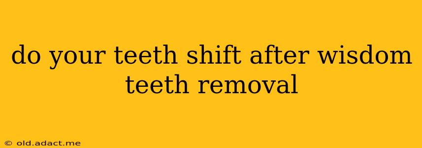 do your teeth shift after wisdom teeth removal