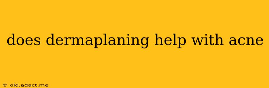 does dermaplaning help with acne