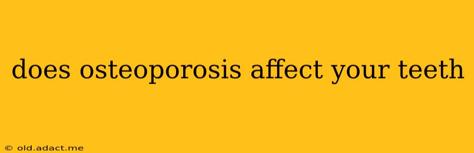 does osteoporosis affect your teeth