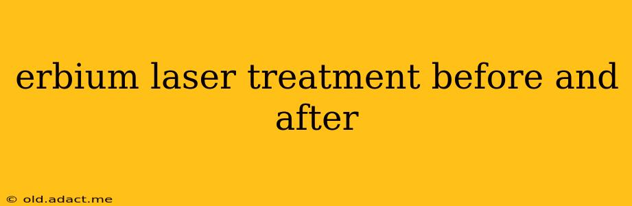 erbium laser treatment before and after