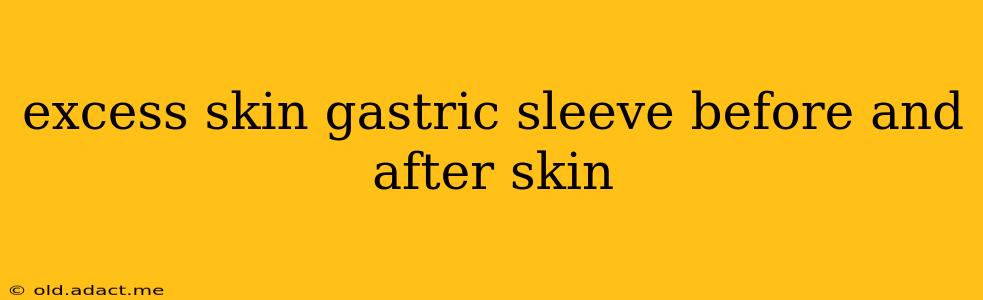 excess skin gastric sleeve before and after skin