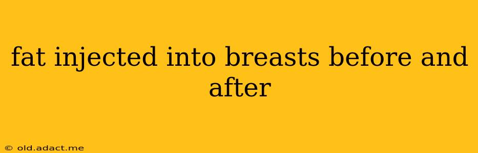 fat injected into breasts before and after
